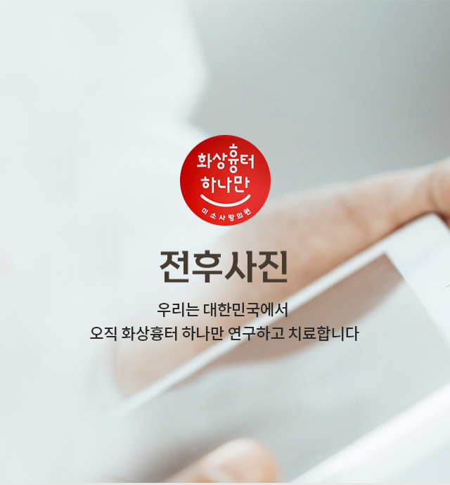 전후사진